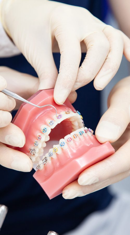 Kimmich_Praxis_Medizinische_Vorteile_fester_Zahnspangen